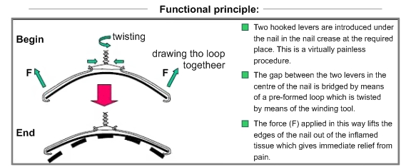 Functional principle