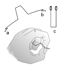 Behandlung-VHO-Osthold-01