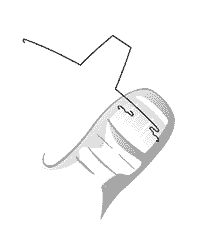 Behandlung-VHO-Osthold-02