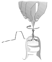 Behandlung-VHO-Osthold-03