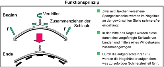 Funktionsprinzip